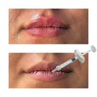 Injectable Hyaluronic Acid Dermal Filler Lip Enhancement Fillers