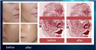 Salon Mesotherapy Injection Pdrn Hyaluronic Acid Skin Rejuvenating Complex Solution