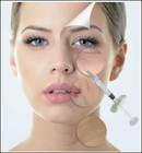 1ml 1.1ml Cross Linked Hyaluronic Acid Dermal Fillers For Nose Midface Cheek
