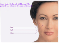 Safe Effective HA Gel Dermal Filler For Reducing Facial Depressions Scars