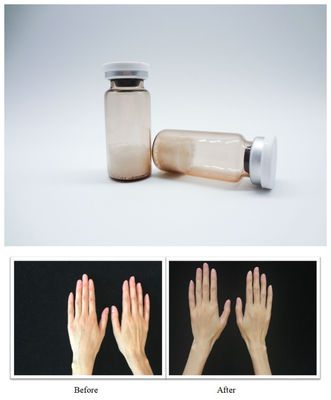 Hyaluronic Acid Dermal Filler Injectable Gel Enables Precise Facial Sculpting and Smooth Skin Texture for Professionals