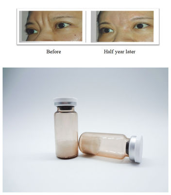 Hyaluronic Acid Dermal Filler Injectable Gel Enables Precise Facial Sculpting and Smooth Skin Texture for Professionals