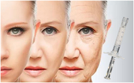 Face Lift PCL Dermal Filler Skin Care Lifting Tightening Stimulating Collagen