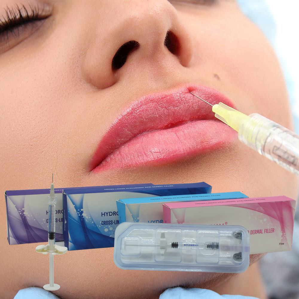 Cross-Linked Hyaluronic Acid Dermal Filler With Lidocaine Facial Injection Syringe Type