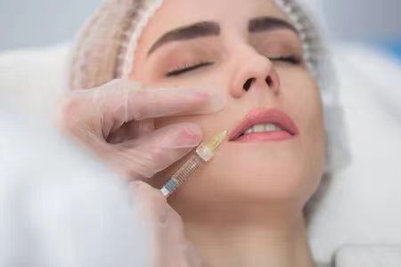 Syringe Packaging Hyaluronic Acid For Wrinkles Nose Filler, Ha Hyaluronic Acid Gel Injection