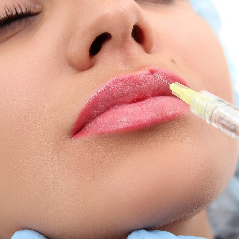 Gel Form Injectable Lip Fillers 24mg/Ml Hyaluronic Acid Natural