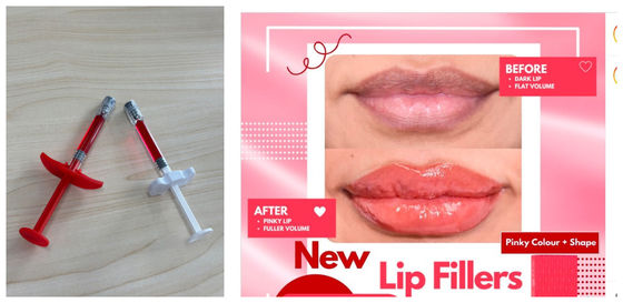 Dermal Lip Fillers Safe Effective For Medical Professionals