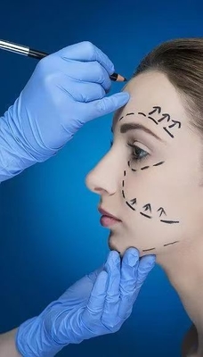 Smooth Wrinkles And Define Jawline With Facial Dermal Fillers 70% HA Cross Linked 24mg 30% Calcium Hydroxylapatite