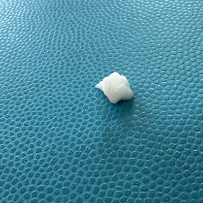 Advanced Filling Effect On Marionette Lines With Calcium Hydroxyapatite Injection