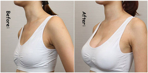 Hyaluronic Acid Breast Injection Filler Breast Sodium Hyaluronate Enhancement Gel